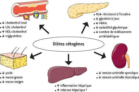 les bienfaits du régime cétogène